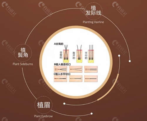 临沂华美植发胡刚说出脱发怎么治更有效