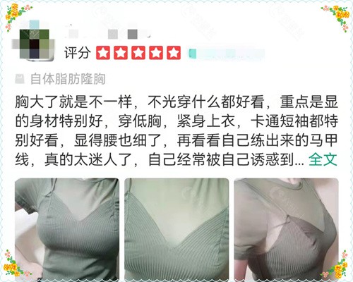 广州中家医黄广香隆胸手术评价