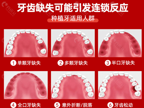 牙齿缺失的情况