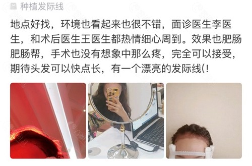 网友在北京大麦微针植发医院做发际线种植口碑评价