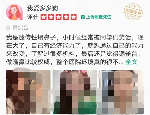 成都铜雀台郭世伟隆鼻术后点评