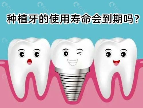 种植牙使用寿命会到期吗？种植牙可以维持多长时间？