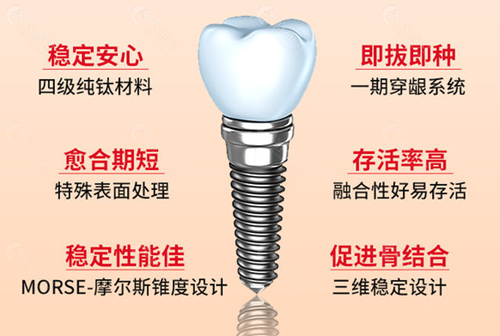 种植牙优势