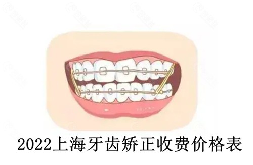2022上海牙齿矫正收费价格