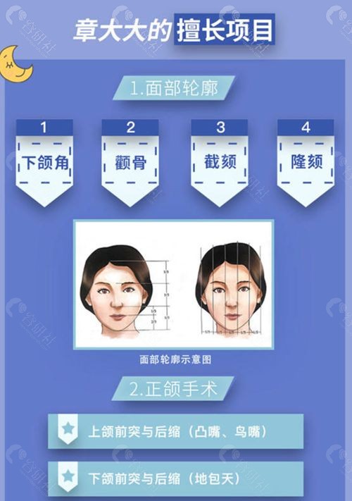 上海下颌角磨骨技术好的医院上海长征医院章建林擅长项目