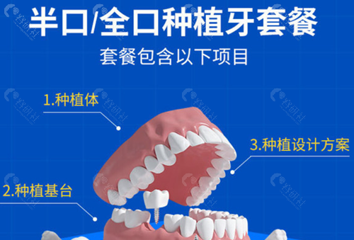 广州穗华口腔医院半口种植牙
