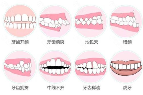 沈阳矫正牙齿哪家牙科便宜又好？沈阳正畸哪个医生好？