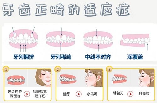 牙齿地包天不治到底有什么危害和影响？