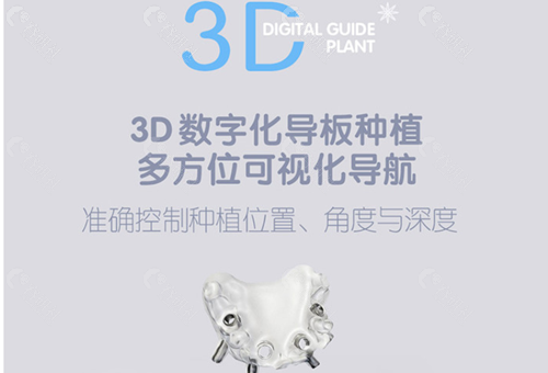 天津海德堡口腔医院3D数字化导板种植牙技术