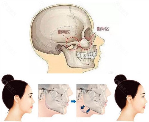 穆雄铮会亲自做手术吗？