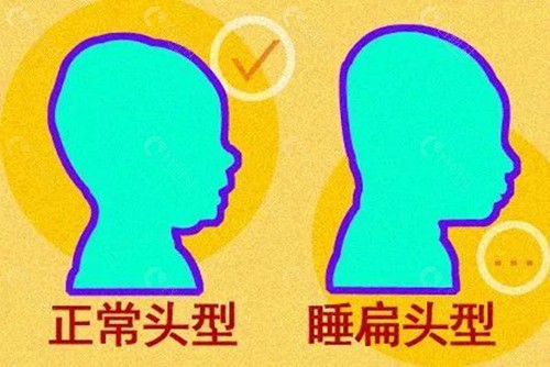 扁头变圆头整形手术哪家医院好？