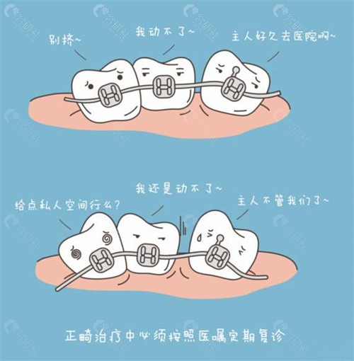 深圳市人民医院牙齿矫正价格表