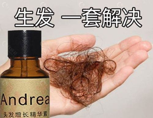 市面上所谓的“生发洗发水”真的能生发吗？