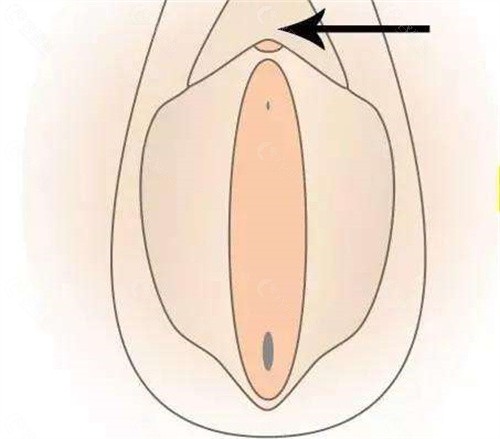 阴唇馒头型/蝴蝶型等目前有哪些改善方式？