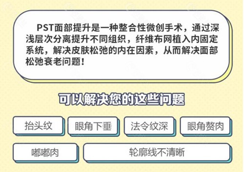 PST技术介绍