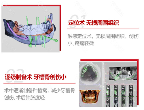 佛山登特口腔种植技术