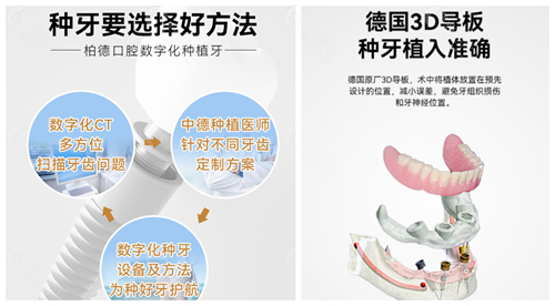 广州柏德口腔医院种植牙优势特色