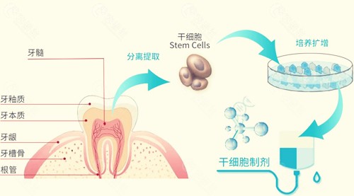 再生牙手术流程介绍