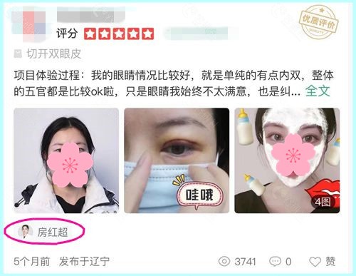 沈阳杏林房红超医生割双眼皮口碑好不好？看网友评价就知道了！