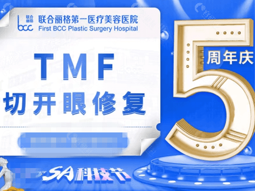 北京联合丽格眼修复怎么样