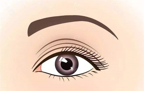 王海平双眼皮修复有哪些优势？