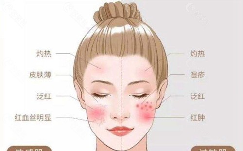 敏感肌红血丝明显.jpg
