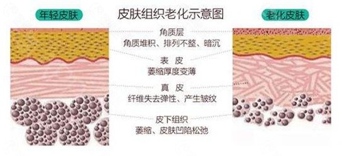 衰老肌肤暗沉松弛.jpg