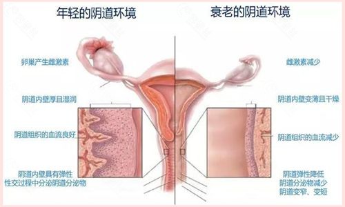 女性私密整形去哪里做好？上海做私密处紧致好的医院有哪些？