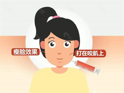 北京瘦脸针哪个医院打的比较好？来看这10家口碑医院名单