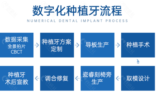 上海華美口腔醫院數字化種植牙流程圖