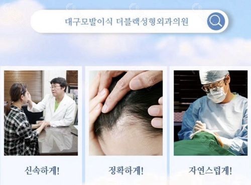 韩国布莱克毛发移植中心头发种植技术怎么样？