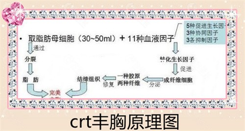 crt丰胸技术原理是什么？