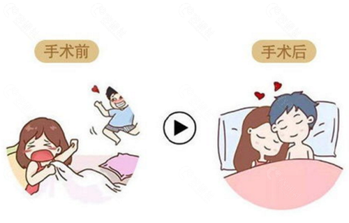 私密紧缩术前后对比