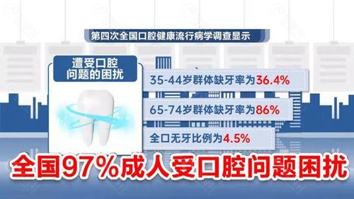 缺牙人群调查