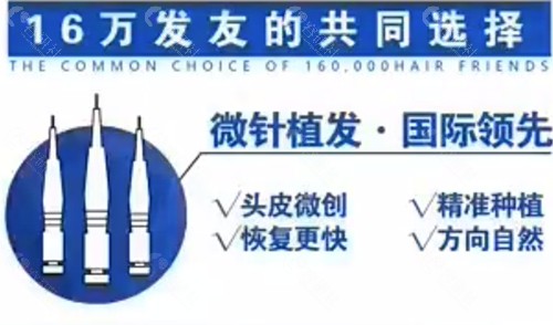 北京大麦微针植发优势介绍