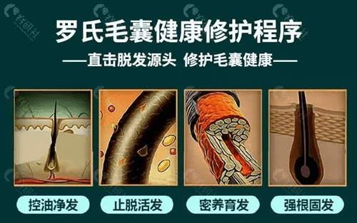 广州罗氏育发生发有哪些功效？