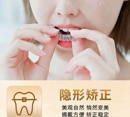 长沙星沙雅贝康口腔隐形矫正