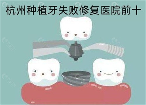 杭州种植牙失败修复医院前十