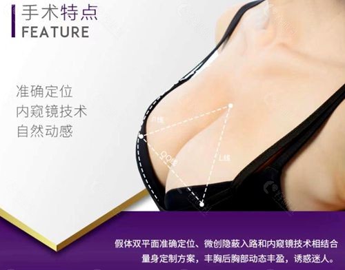 杭州维多利亚医疗美容医院刘中策胸部整形手术特点