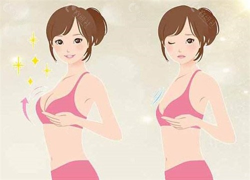 上海张敬德医生隆胸评价怎么样？