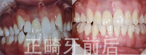 北京诺美口腔门诊部牙齿矫正价格