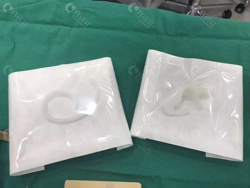 韩国普罗菲耳郑在皓院长耳再造手术使用的人工支架