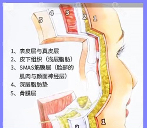 祝东升做五层面部提升优势