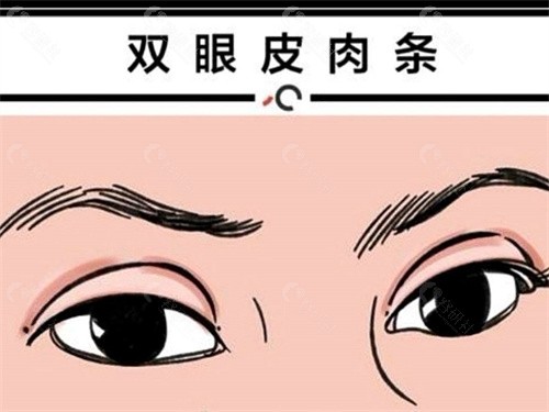 深圳金鑫双眼皮修复口碑如何？