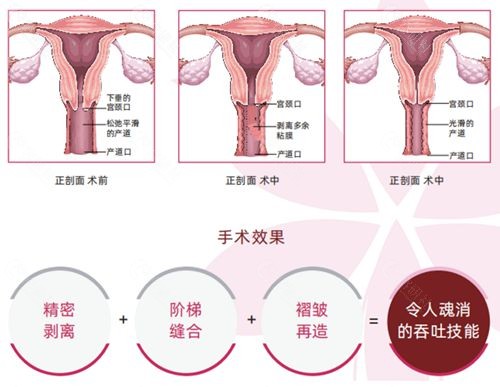韩国好手艺子宫复位健康管理术的技术优势
