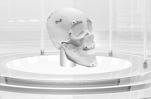重庆当代整形外科医院3D定制面部重建技术好不好？