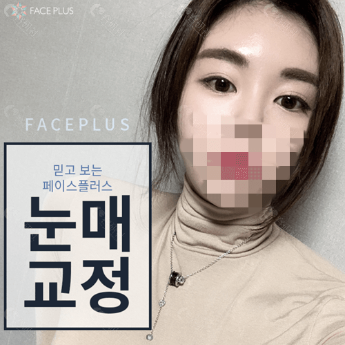 faceplus整形外科眼型矫正