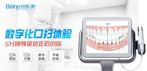 扬州贝恩口腔数字化口扫