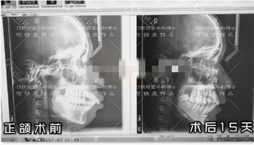 广大整形医院正颌手术口碑如何呢？