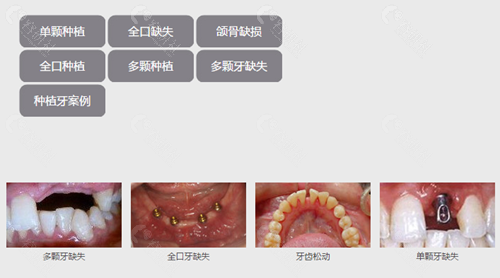 宁波牙博士口腔种植牙